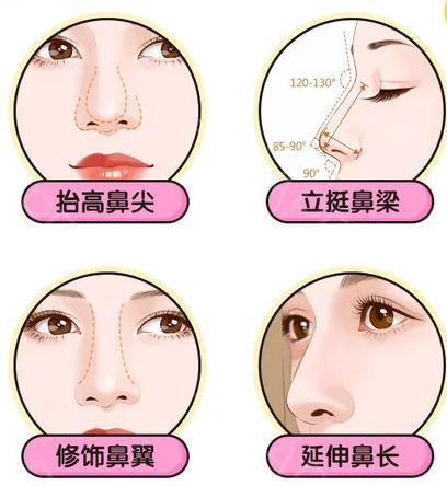 自体耳软骨隆鼻是永久的吗？