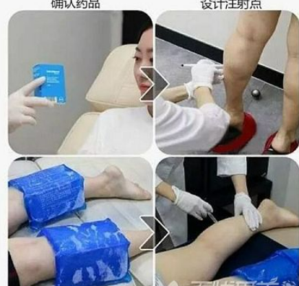 注射是什么？爱美小姑娘快看过来！