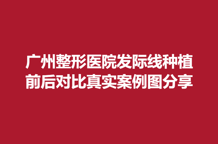 广州整形医院发际线种植，前后对比真实案例图分享