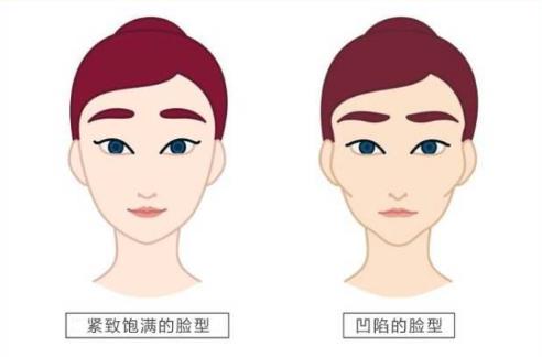 南京鼓楼医院整形科面部提升整形手术案例分享，附相关问答