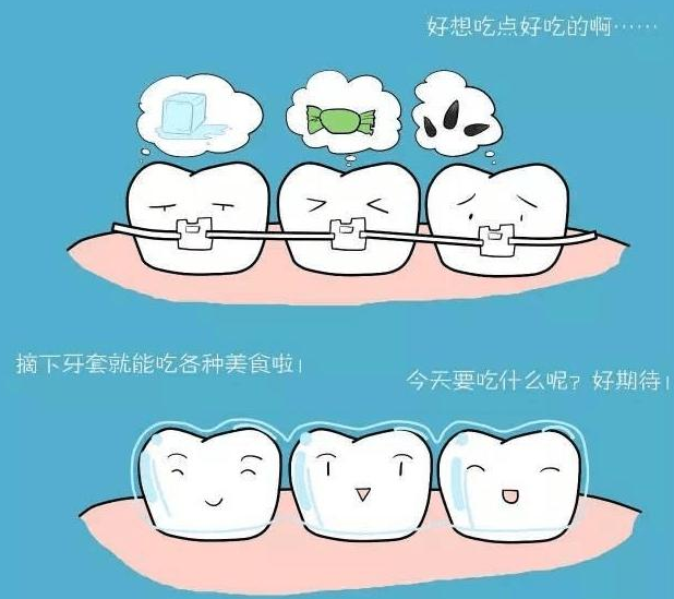 金属托槽矫正注意事项有哪些？
