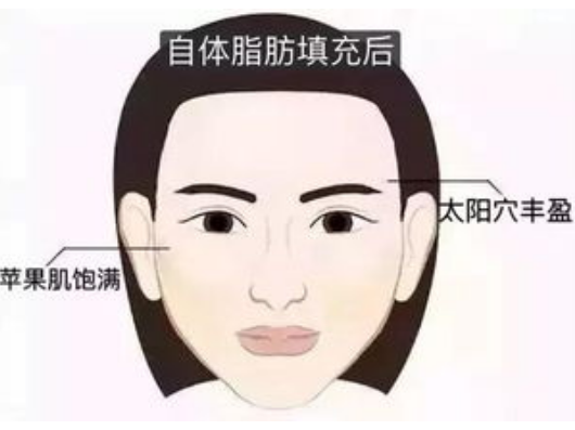 艾莉薇红色和蓝色区别是什么？