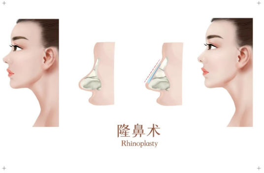 石家庄鼻部整形价格是多少?查看top3医美机构详细资料