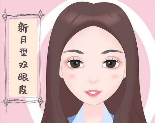 景德镇市第一人民医院美容整形外科做双眼皮怎么样?术前术后效果解析