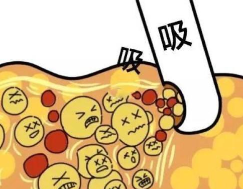 河北省中医院美容科专家介绍,吸脂\双眼皮等项目均有实力医生