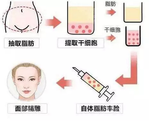 青岛大学附属医院整形科面部填充怎么样？案例分享