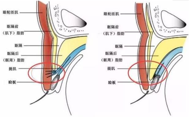 北京中西医结合医院做双眼皮怎么样？快来解锁自然美眼攻略