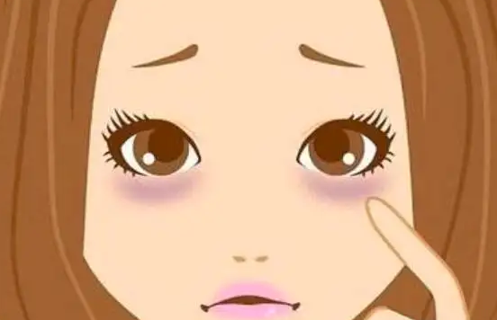 如何跟眼袋说拜拜，激光去眼袋了解一下！
