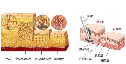 北京301医院整形修复科怎么样？医院室例分享+2024价格表