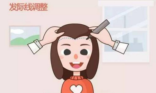 种植发际线一般维持几年？植发亲身经历感受分享