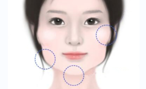 西安市中心医院磨骨费用高吗？科室实力&案例详情分享