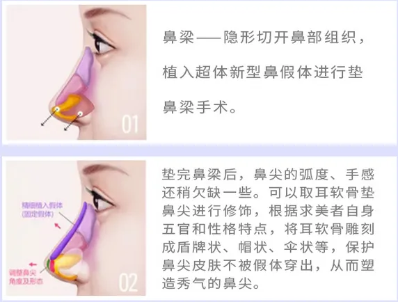 武汉大学中南医院整形外科怎么样？医院信息详情+医院价格表详细