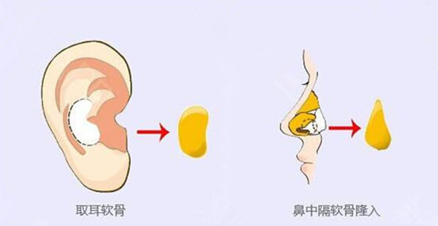 中山市中医院整形科好不好？案例分析