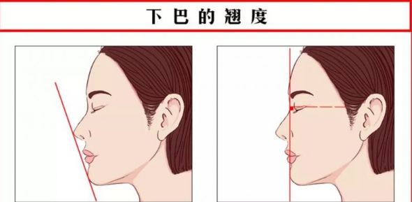 艾莉薇风尚玻尿酸可以打哪里？玻尿酸丰下巴案例效果参考