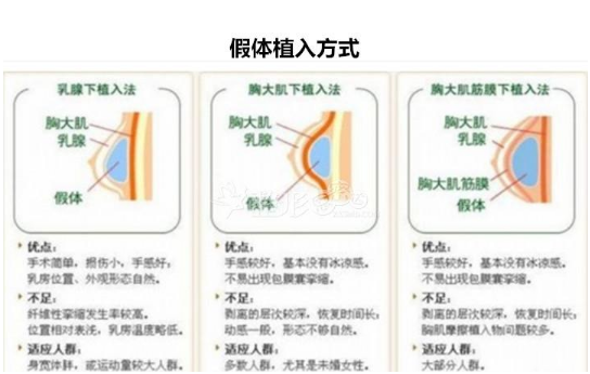 安医大第一附属医院硅胶隆胸收费怎样？看机构背景资料及案例信息