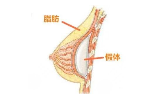杭州盛星国际医疗整形医院假体隆胸效果好不好？医院信息介绍+价格详情