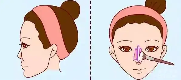 武汉美莱周旭刚医生怎么样？隆鼻小科普&案例果反馈