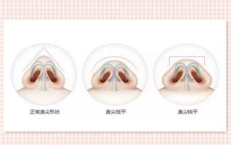 惠州中心医院美容整形科膨体隆鼻怎么收费？详细科室详情+医生推荐