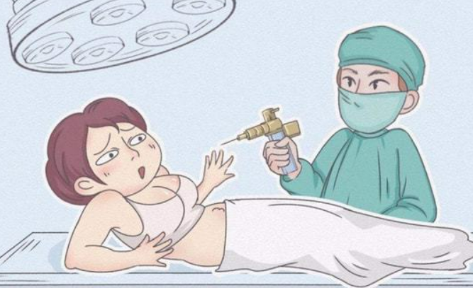 惠州伊丽莎白整形美容医院地址在哪儿？医院医生资料整理，吸脂案例
