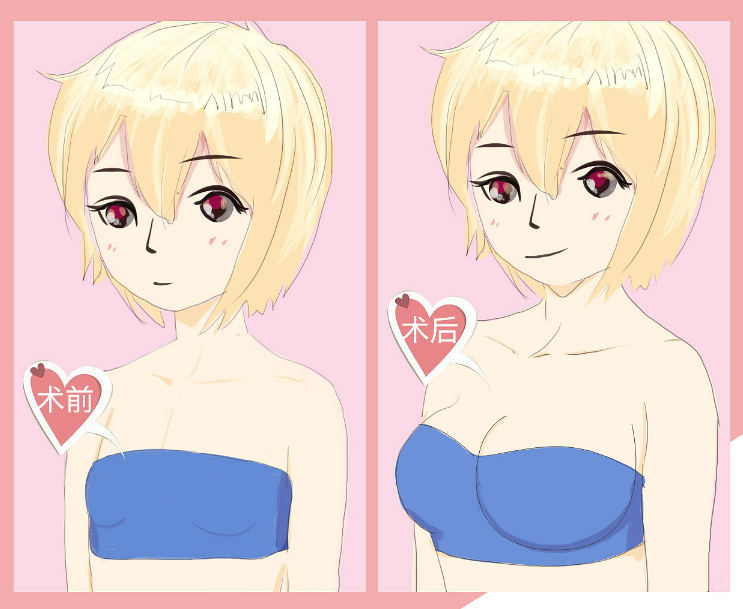 image.png image.png