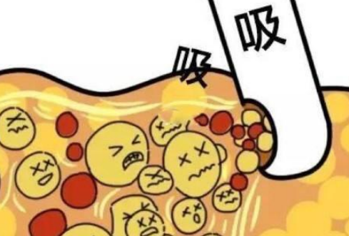 广州韩妃吸脂怎么样？收费明细及医院信息汇总