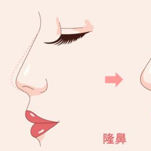 中山禾佳医疗美容隆鼻价格公布~医院资料及收费标准附上