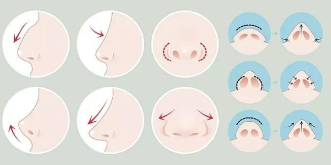 image.png image.png