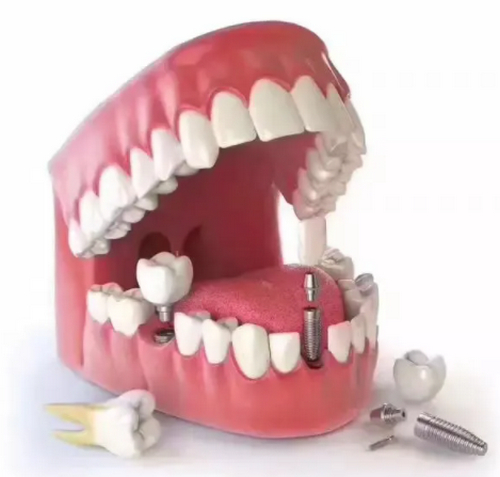 年轻人适合种登腾吗？