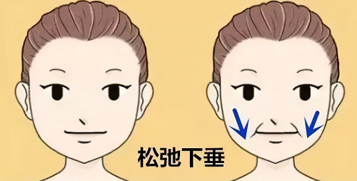 23.png