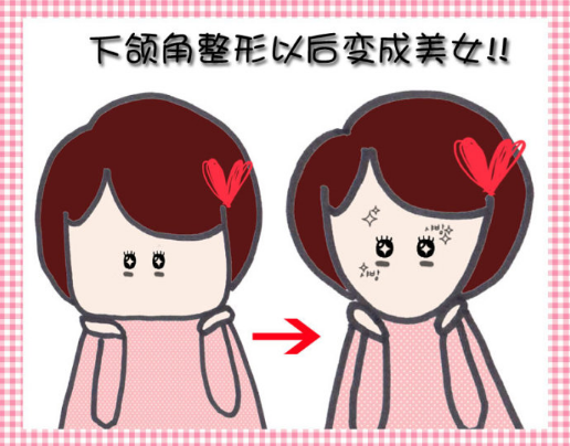 青岛亚美整形美容医院整形科颧骨整形好不好？技术水平和简介解析