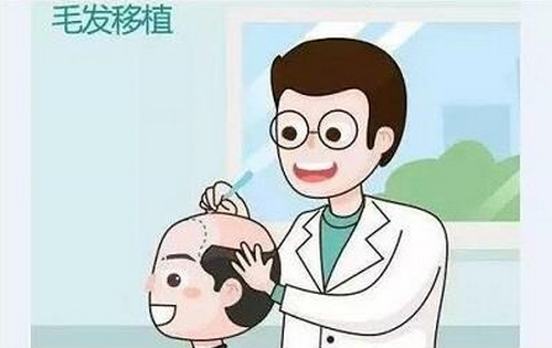 青医附院整形美容科植发多少钱？一起来看植发案例分享