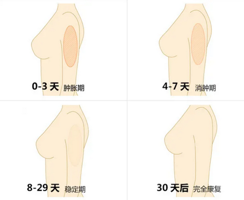 鸡西矿业集团总医院整形科吸脂怎么样？价格表和医院信息速来了解