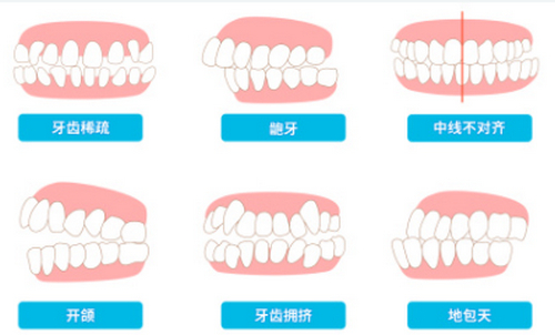 保定市第二医院口腔科牙齿矫正怎么样？详细案例分享+价格表参考