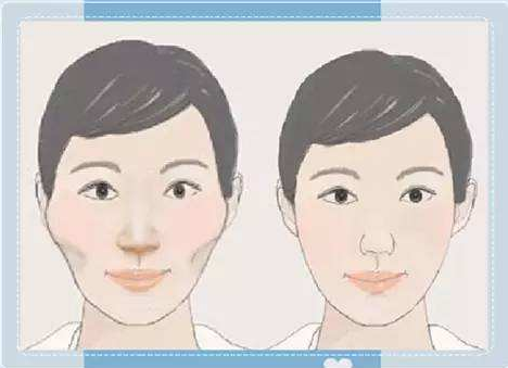海南瑞韩美容整形怎么样？医院优势？技术好不好?真人案例分析