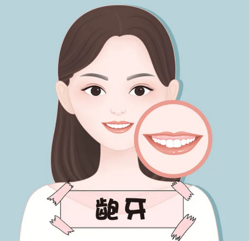 北京大学口腔医院做正畸要多少钱？牙齿矫正经历参考：戴牙套一年会改变颜值吗?