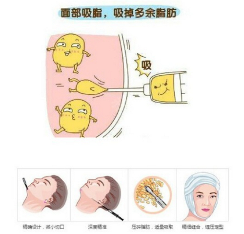 北京伊美尔紫竹整形美容医院抽脂靠谱吗？医院简介速览~