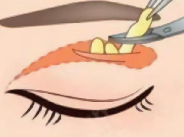 image.png image.png