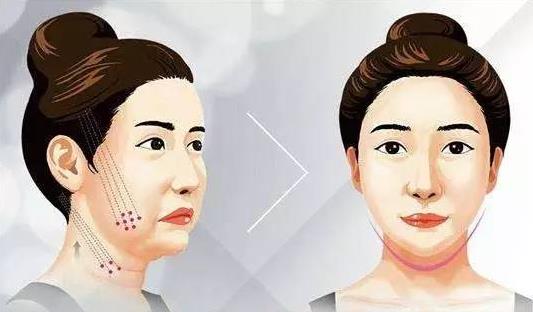 超声炮刀头和炮头的发数区别是什么？