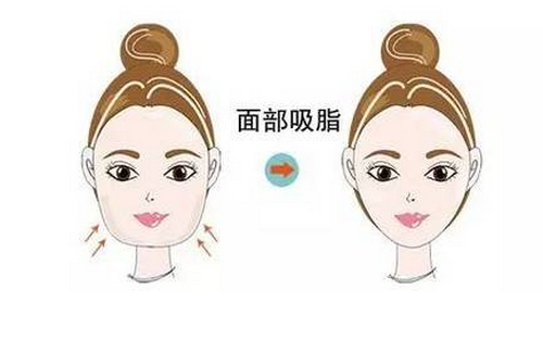 北京同仁医院整形科怎么样？详情医院资料+收费标准