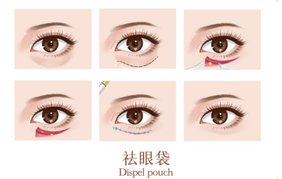 北京艺星医疗美容_微信截图_20230220145228.png