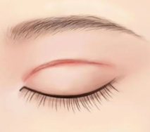 双眼皮8.png
