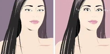 双眼皮6 (2).png