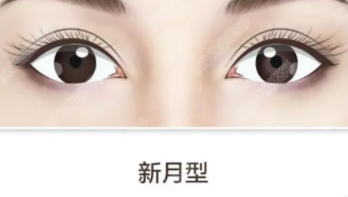 双眼皮2.png