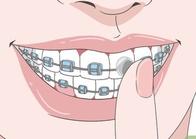 bf00ba01-697d-4763-8454-f05819f7b032.png bf00ba01-697d-4763-8454-f05819f7b032.png