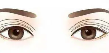 双眼皮4 (2).png