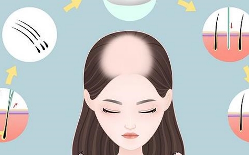 汉大治美尚美医疗美容医院植发多少钱？过程分享