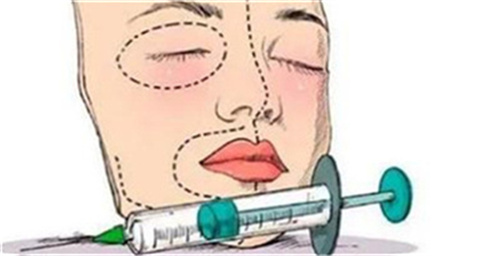 玻尿酸注射15.jpg