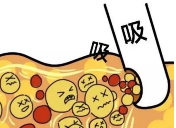 image.png image.png