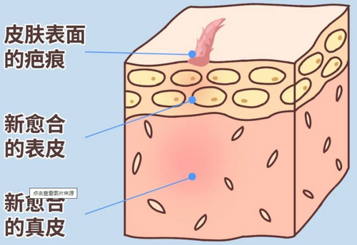 西南医院双眼皮整形怎么样？真人反馈详情