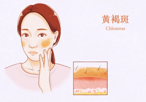 中山韩妃整形医院做皮秒祛斑技术好吗？快来看看有哪些专业医生